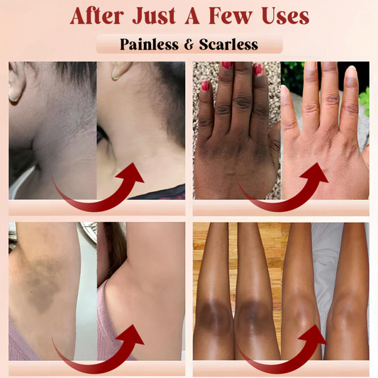 GlowSkin™️ Exfoliating Gel (The Original & #1 Recommended)